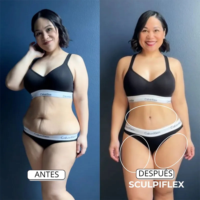 SCULPIFLEX