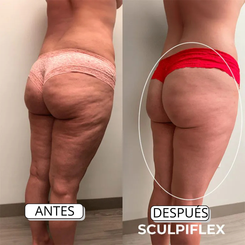 SCULPIFLEX