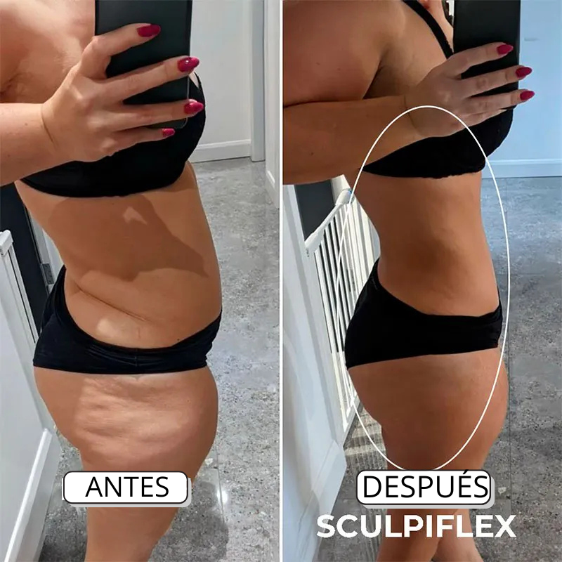 SCULPIFLEX