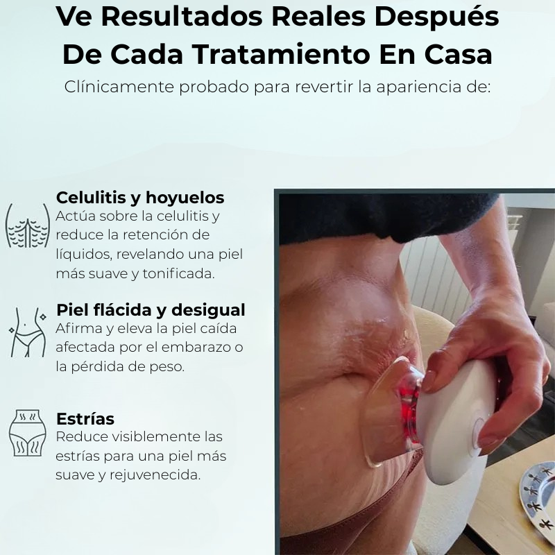 SCULPIFLEX